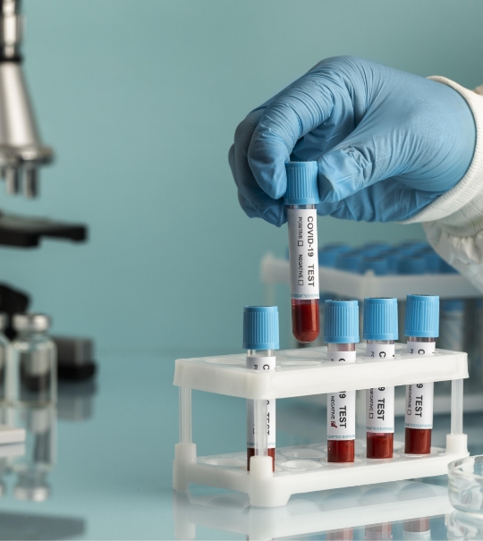 Hand-With-Protective-Gloves-Holding-Blood-Samples-Covid-Test